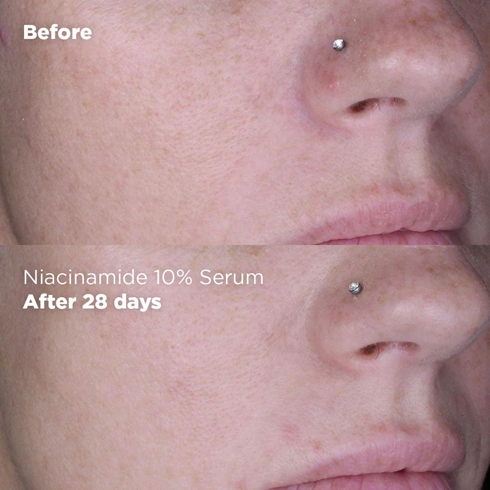 Brightening Niacinamide 10% and Zinc 1% Serum